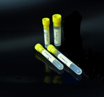 Provette 12x86 mm - 0,25 ml di Sodio Citrato - 2,25 ml image 0